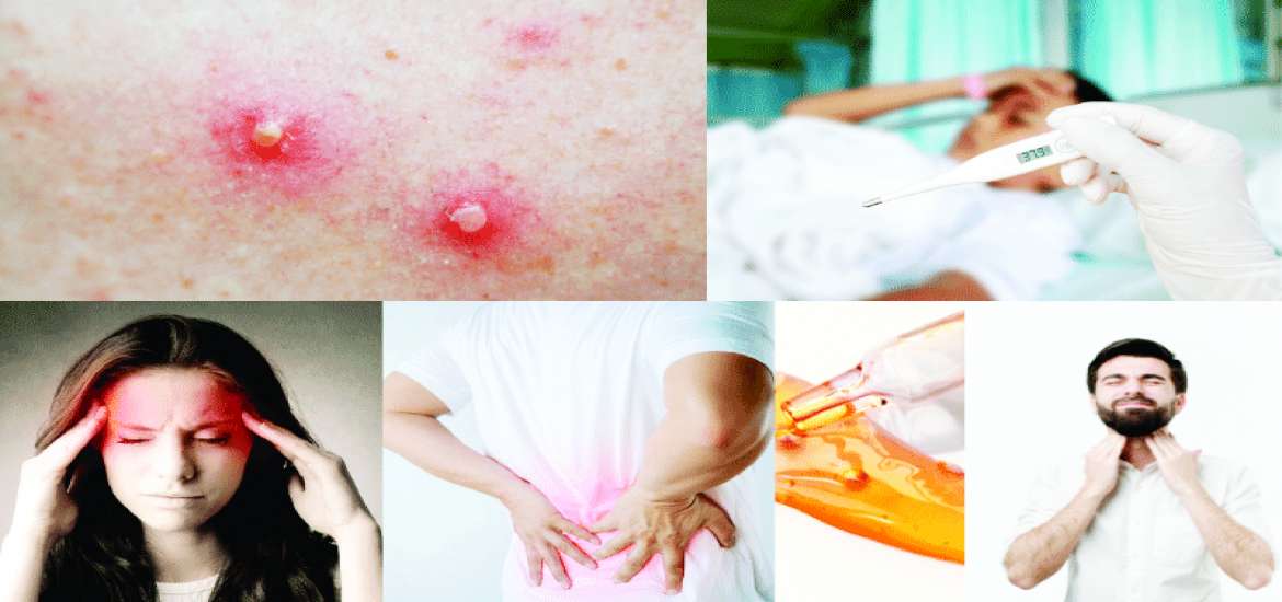 ဆောင်းပါး